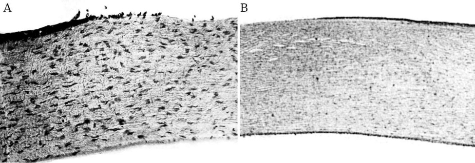 Other acute eye lesions