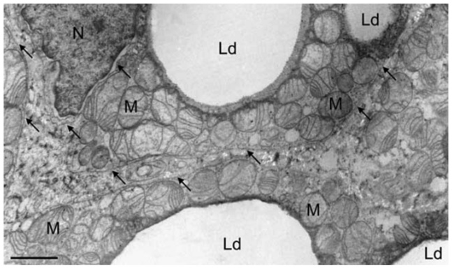 Electron-microscopic picture of brown fat tissue, showing multiple fat
                    droplets and abundant mitochondria