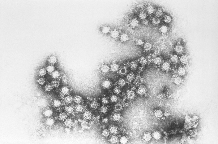 Electron-microscopic picture of Coxsackie virus