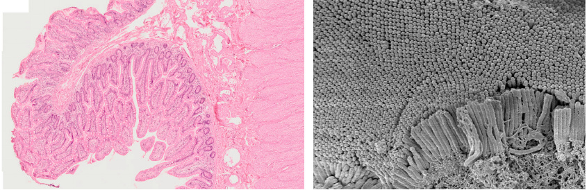 Microscpic picture of the intestinal mucous membrane, and electron
                    microscopy of an individual intestinal epithelial cell