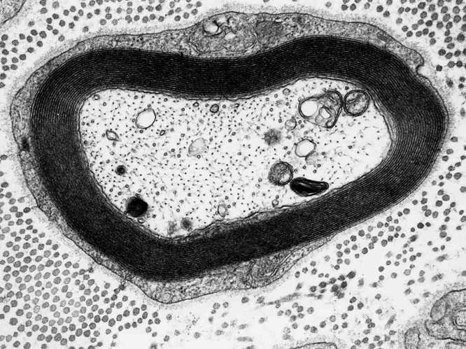 Electron microscopy of a myelinated nerve fiber (cross section)