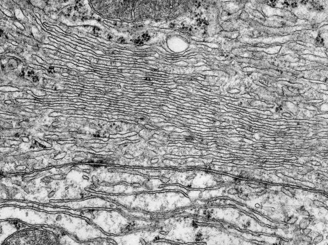 Electron microscopy of smooth endoplasmic reticulum