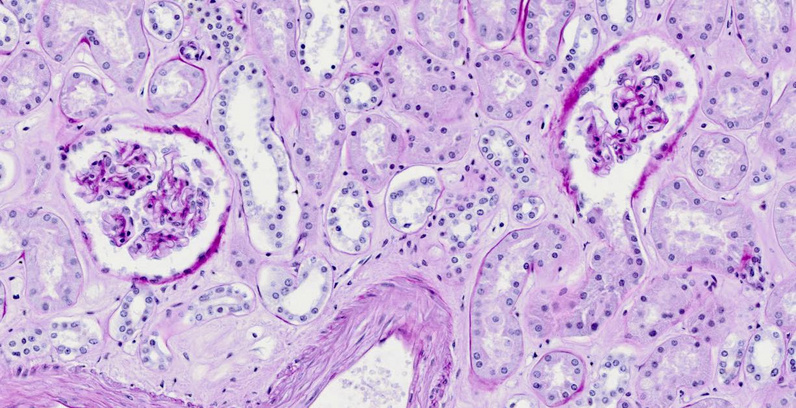 Cross sections of glomeruli and tubules in kidney
