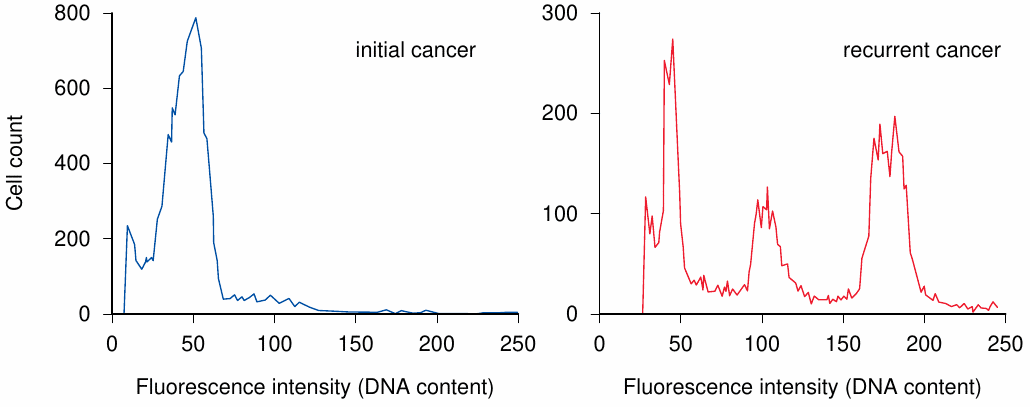 Progressive cell aneuploidy in a recurring tumor